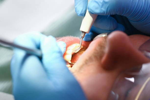 Best After-Hours Dental Trauma Care in Richmond, IN